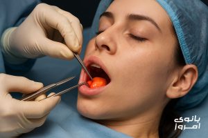 عمل بوکال فت چیست و چگونه انجام میشود