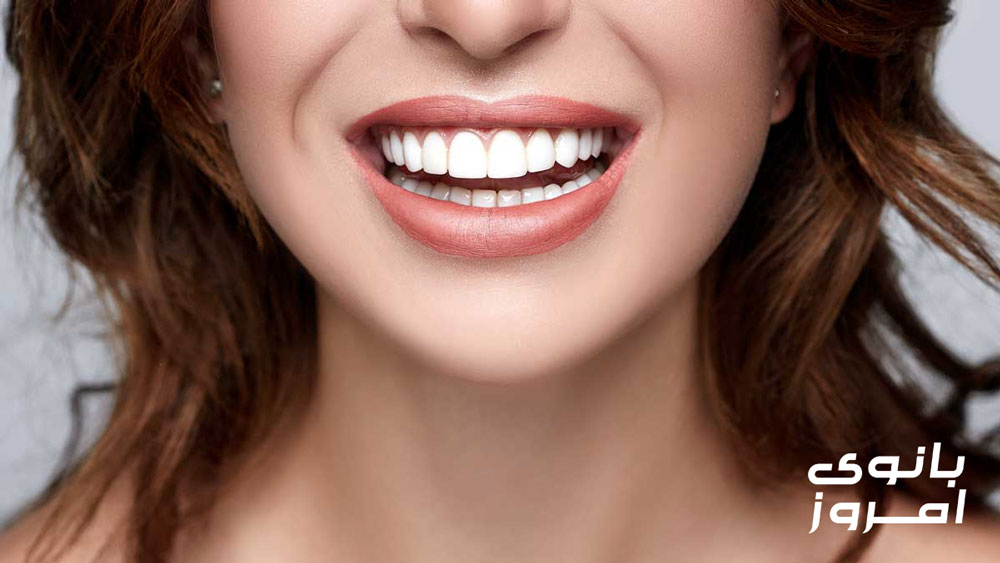لبخند هالیوودی چیست؟